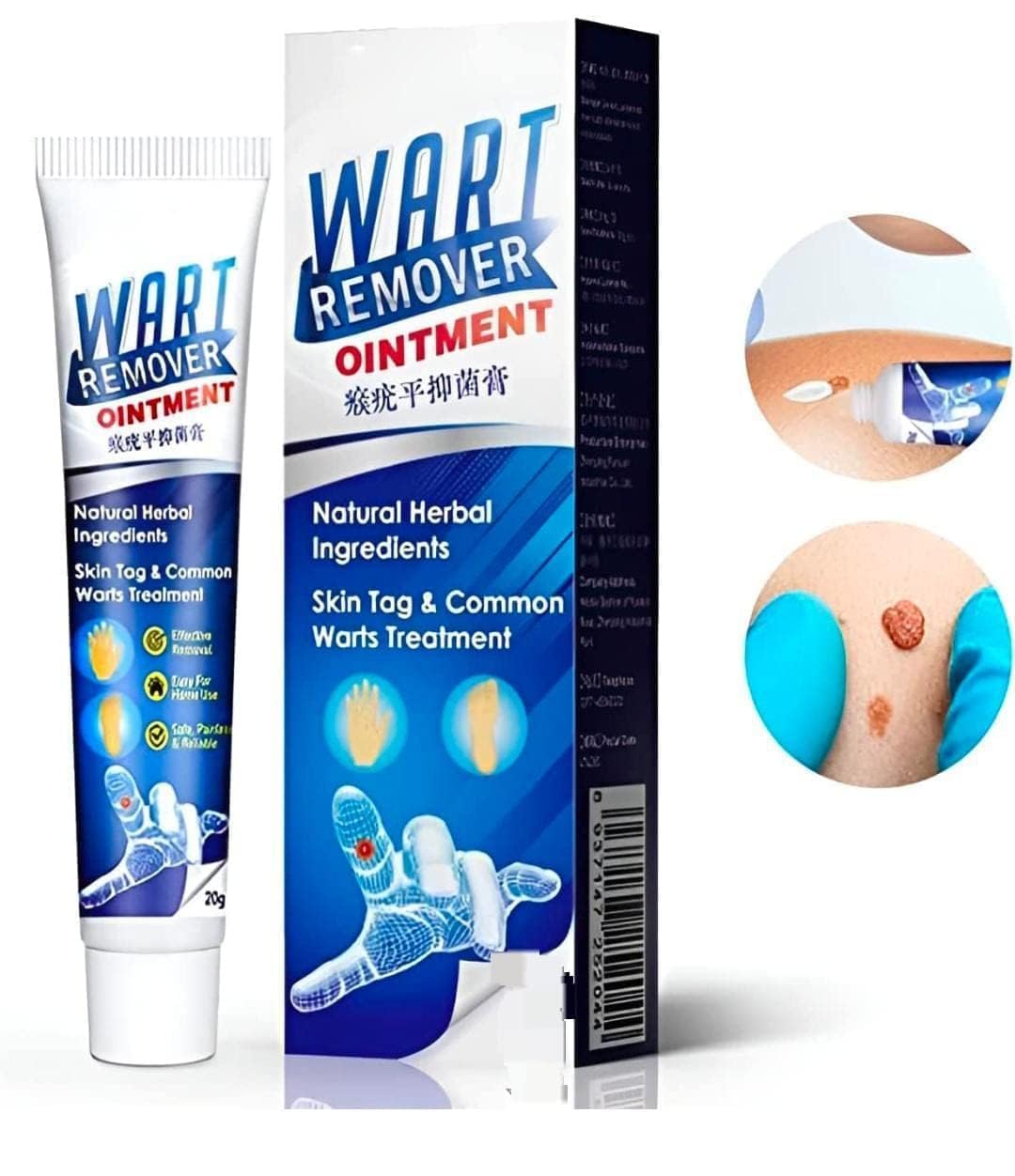 Wart Remover Ointment - For Skin Tag & Wart Removal