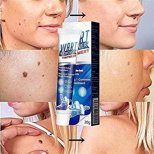 Wart Remover Ointment - For Skin Tag & Wart Removal