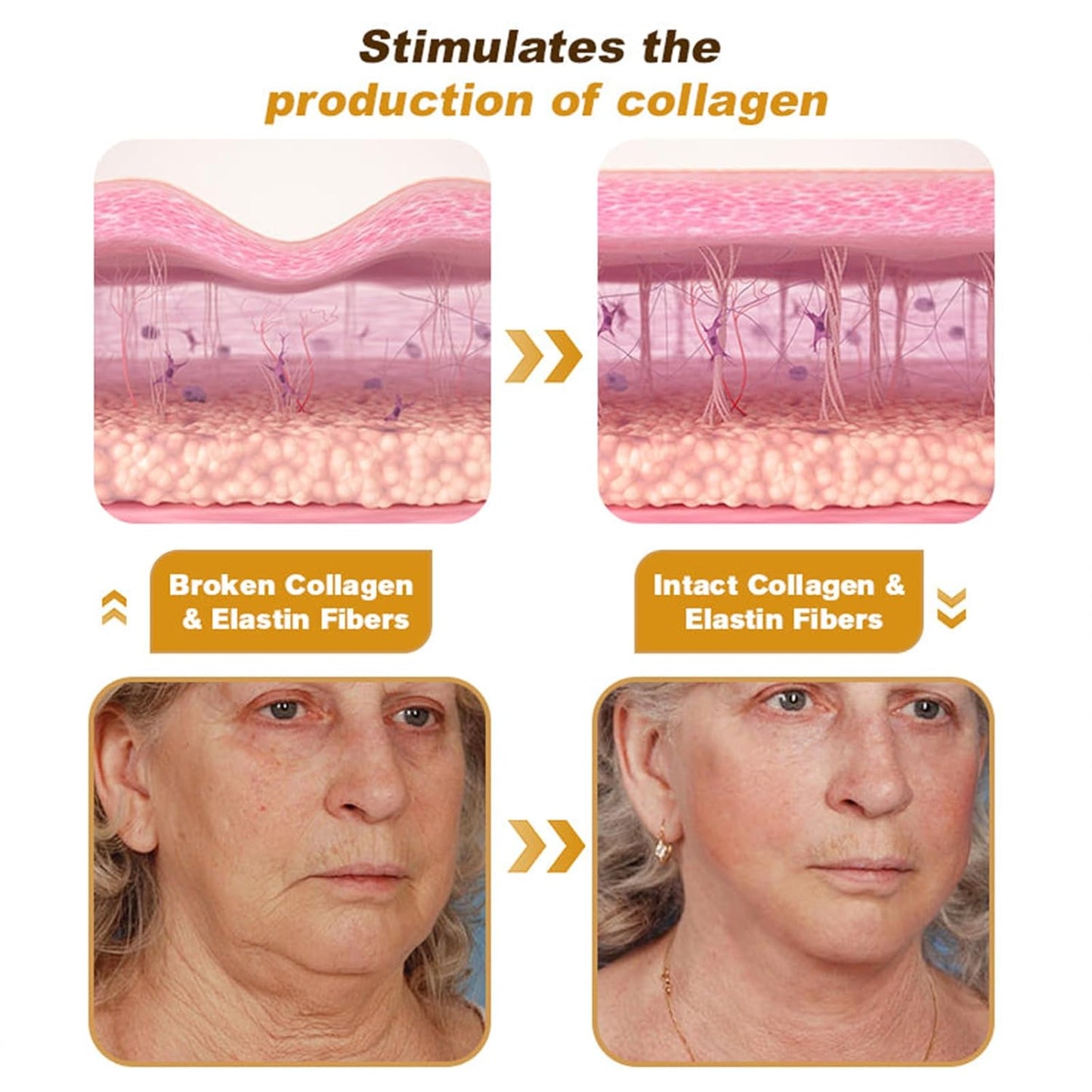 Botox Bee Venom Anti-Wrinkle Cream - Anti-Wrinkle , Anti-Aging, Moisturizing, Lifting & Firming Cream –Recovery Cream for All Skin Types