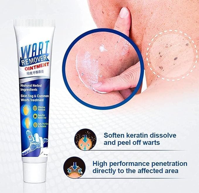 Wart Remover Ointment - For Skin Tag & Wart Removal