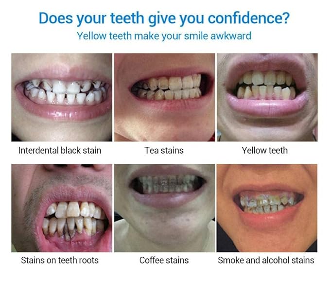 Instant Teeth Whitening Essence - Professional & Easy Teeth Whitening Essence ( BUY 1 GET 1 FREE )