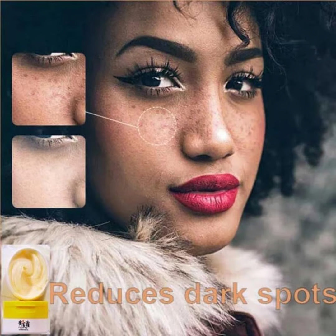 Dark Spots and Acne Removal Cream (BUY ONE GET ONE FREE)