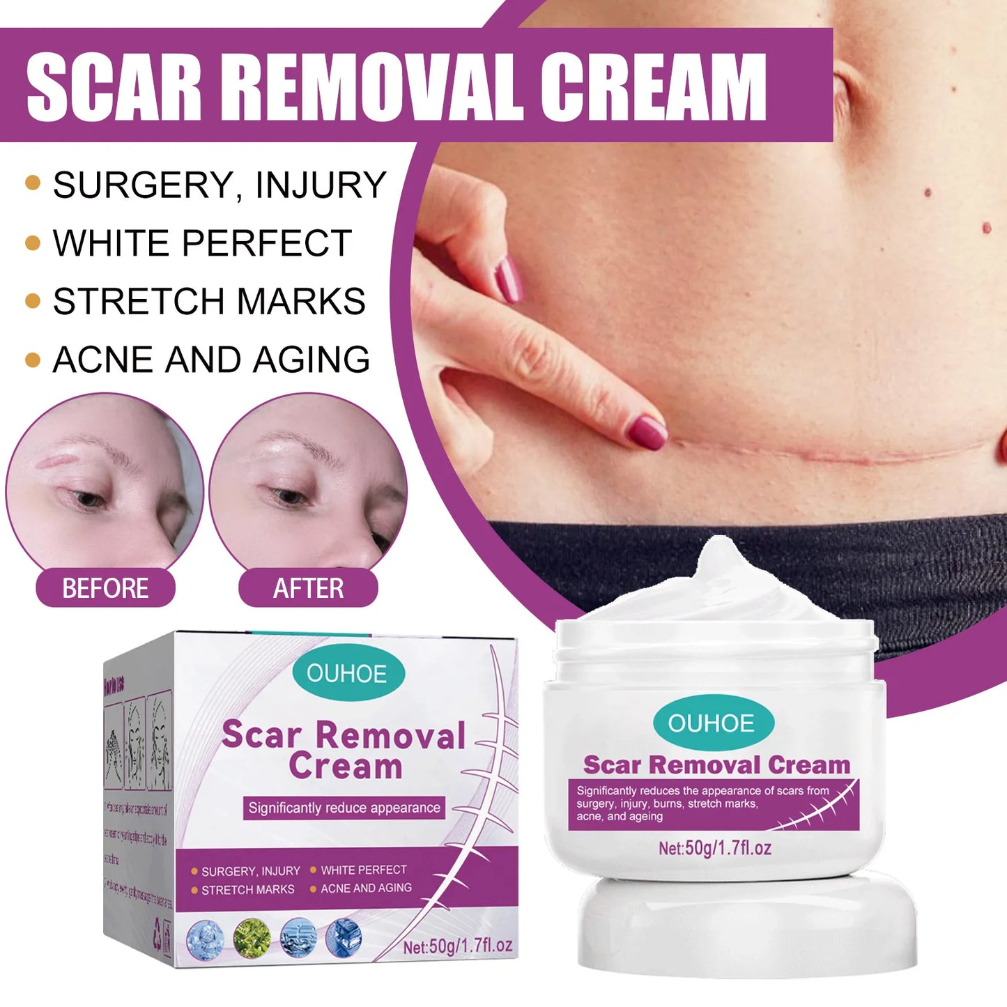 Scar & Stretch Marks Removal Cream