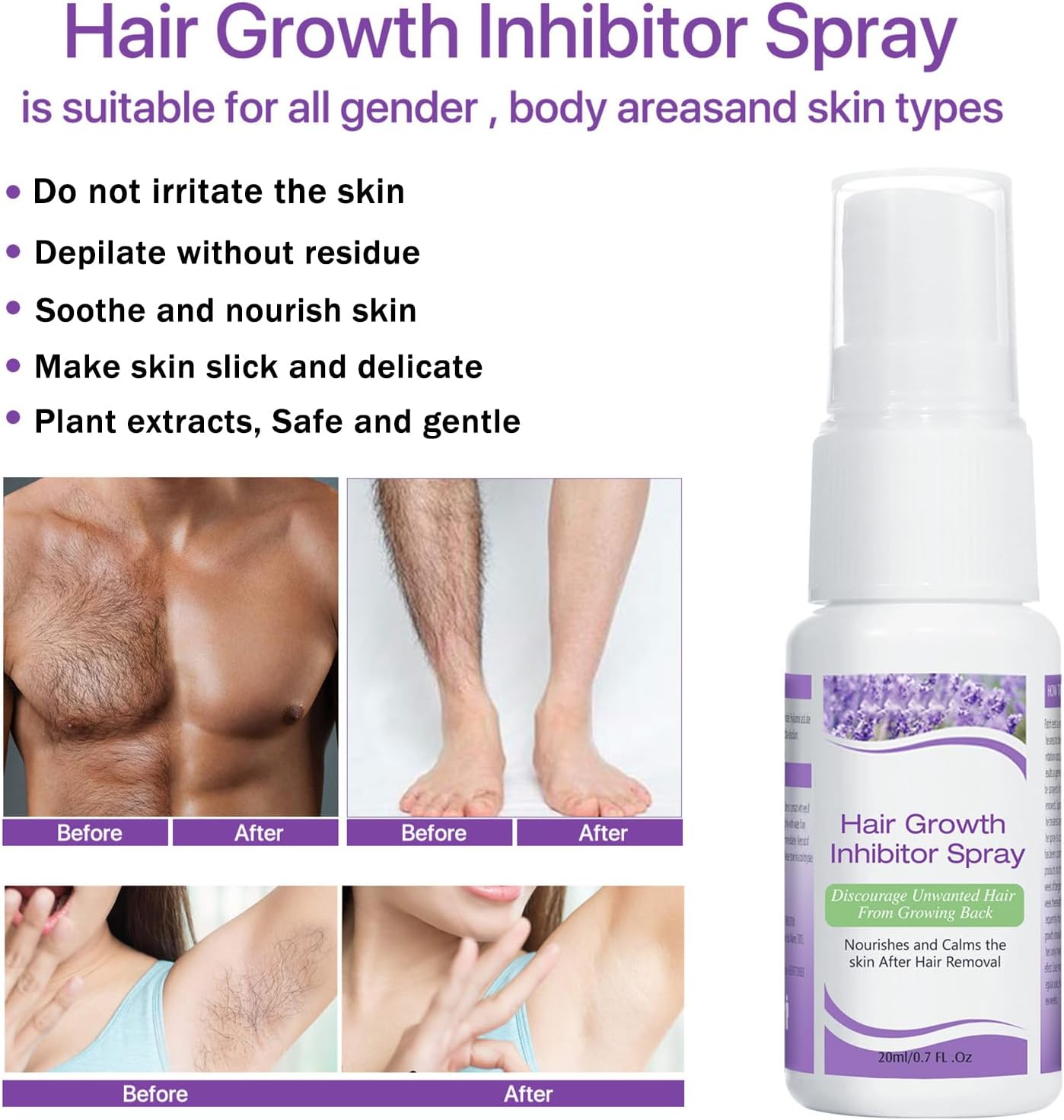 Hair Growth Inhibitor, Hair Stop Growth Spray, Non-Irritating Hair Inhibitor, Permanent Hair Removal Spray for Body, Face, Underarm, Arm, Leg, Private Areas, Painless Men and Women Effective ( A Pack of 2 Pieces; 20mls Each)