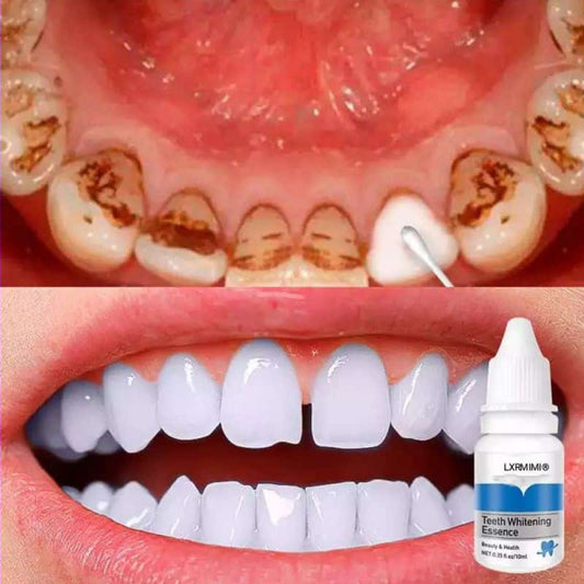 Instant Teeth Whitening Essence - Professional & Easy Teeth Whitening Essence